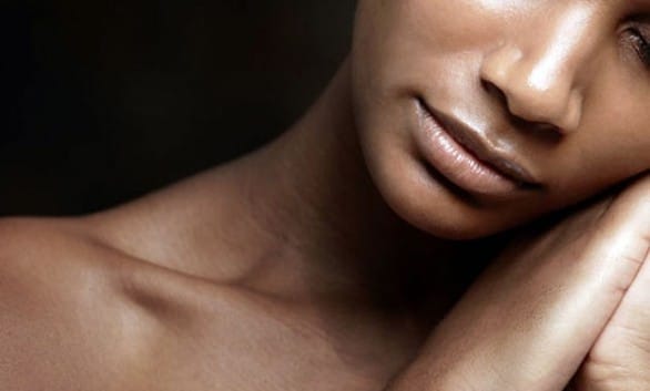 foliculite pele negra