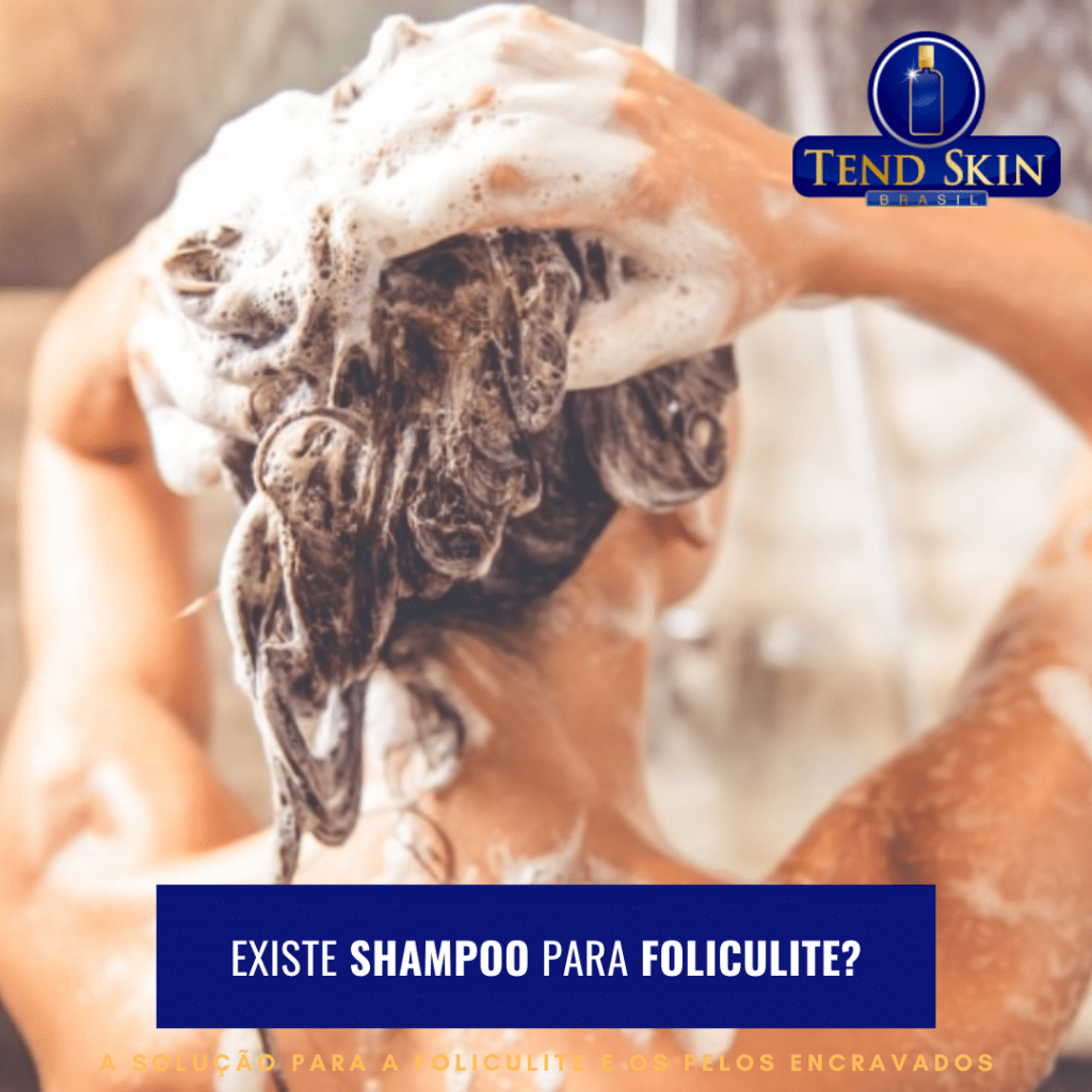 Cetoconazol para foliculite