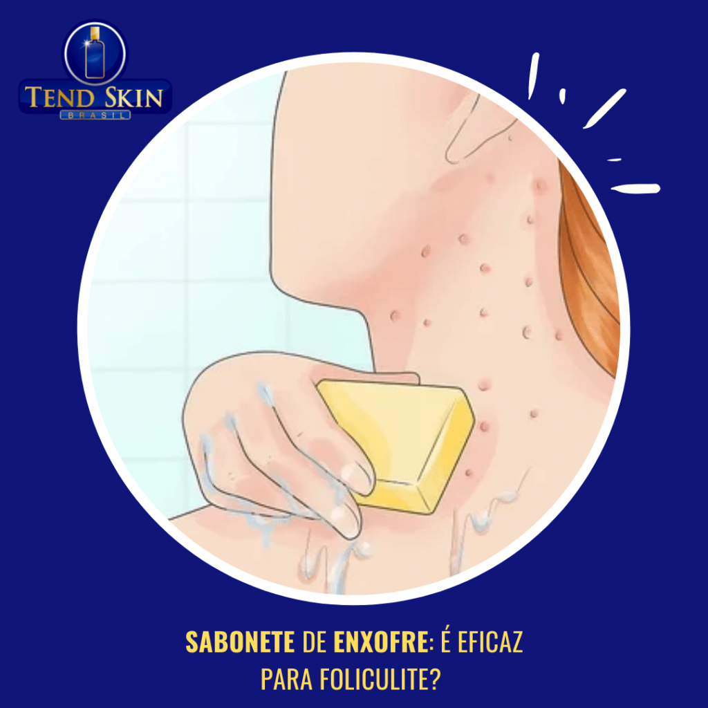 sabonete para foliculite