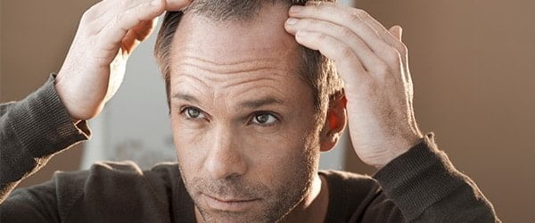 Foliculite decalvante