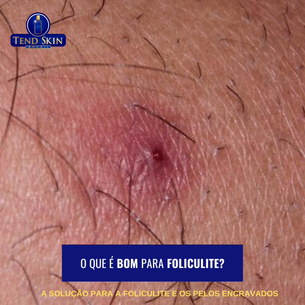 tratamento para foliculite